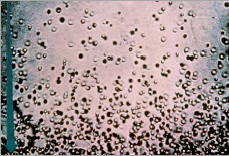 Figure 3 - Microphotographie de la répartition en hauteur de
          sphérules de résine en suspension dans l’eau. Photographie
          reproduisant un cliché de Perrin, réalisée par le palais de la
          Découverte pour la présentation de ses expériences sur le mouvement
          brownien.